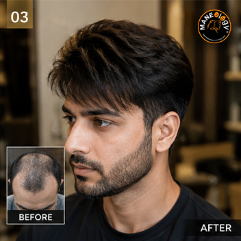 Maneology Hair Patch